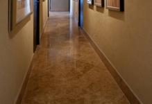 Aesthetic-improvement-hallway-photo-10